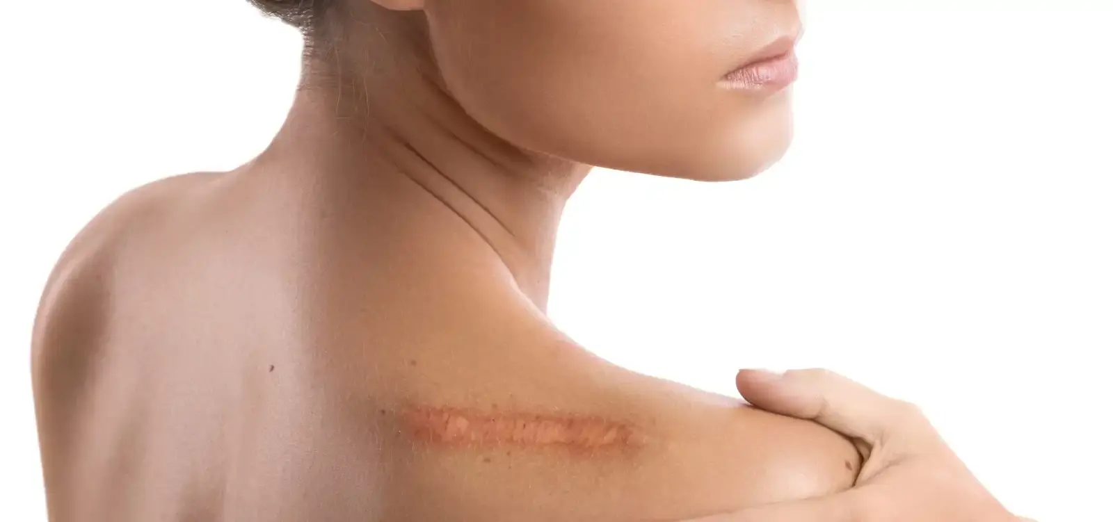 Remove Your Scars